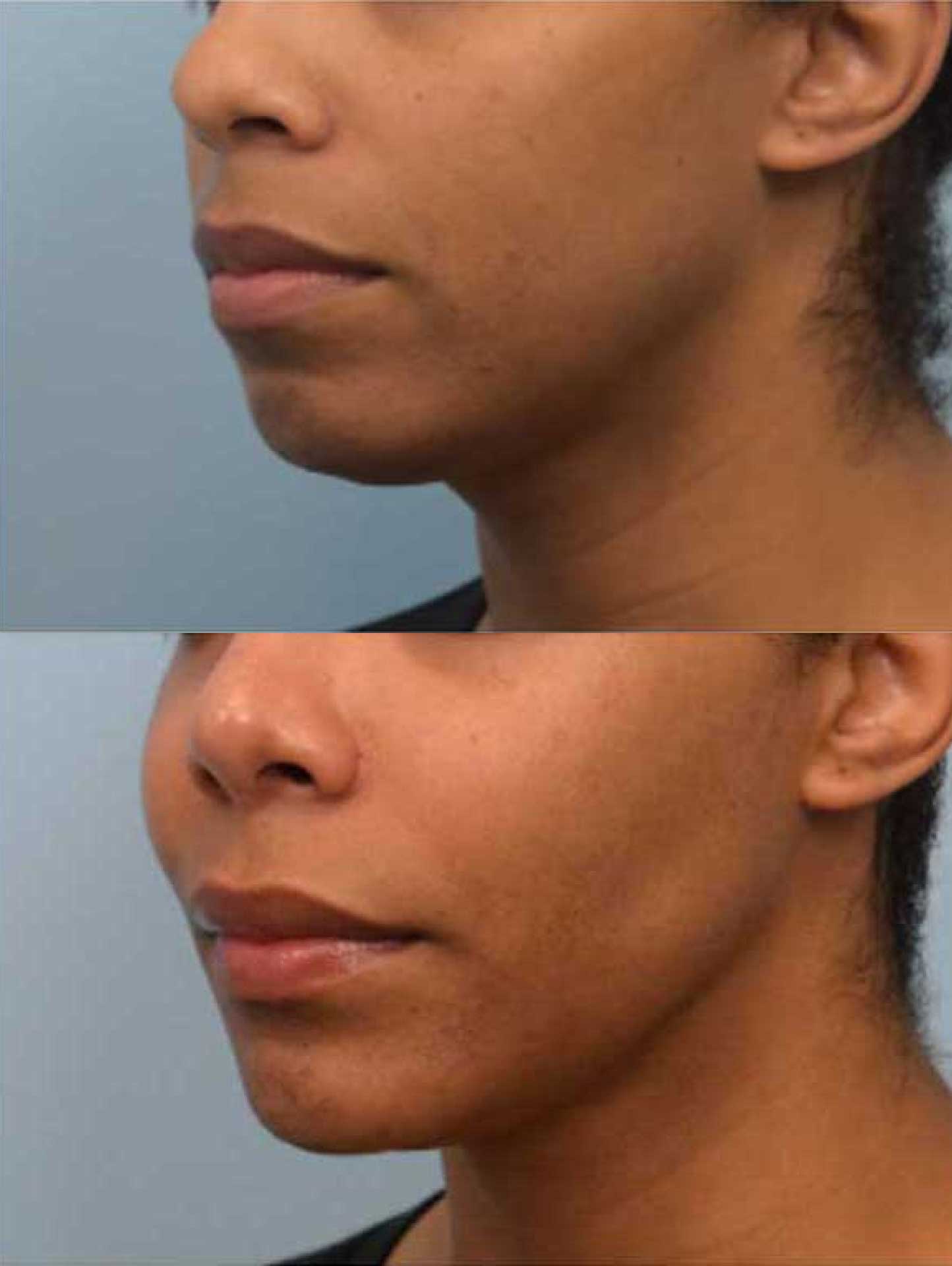 Facial Plastic Surgery Houston Face Forward Houston