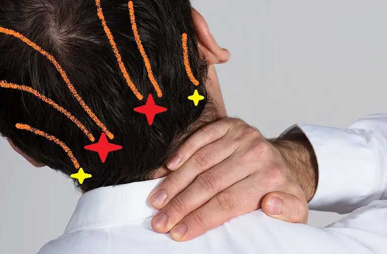 Nerve Decompression - Rodman, Regina (faceforwardhouston.com) Houston