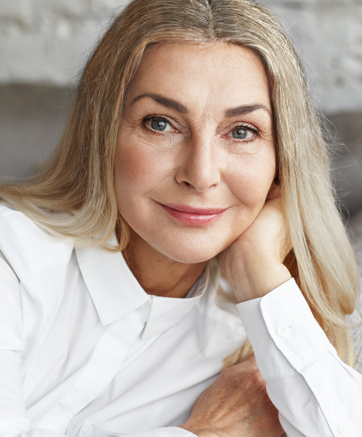 Brow Lift For Facial Feminization Houston 