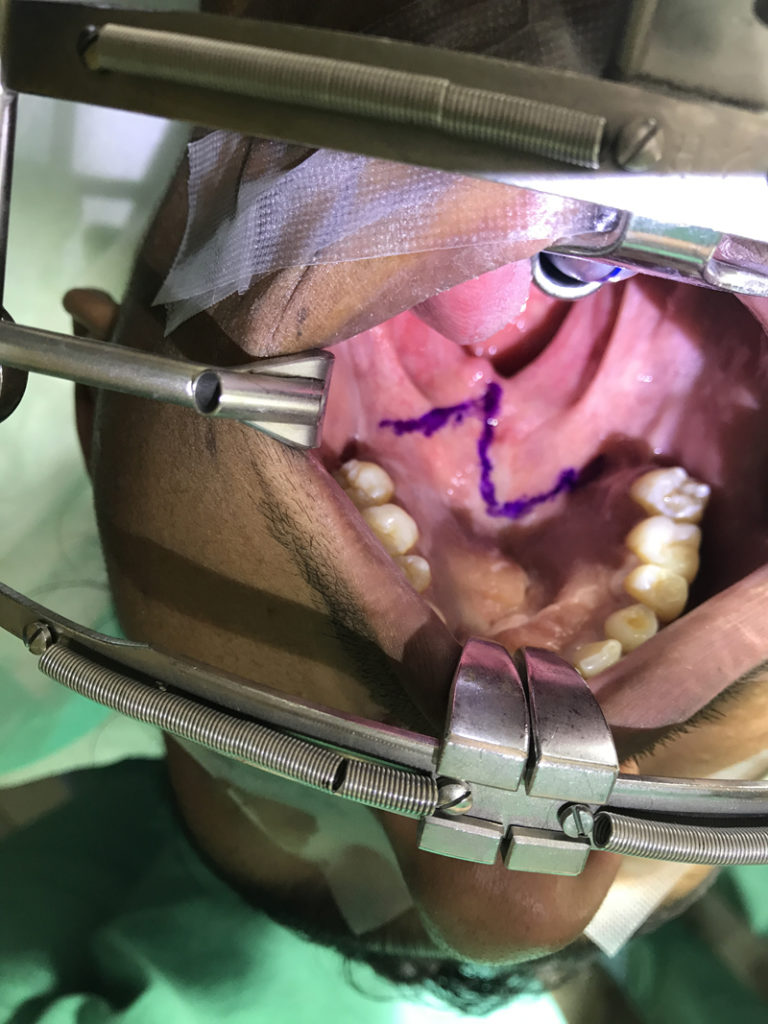 Plastic Surgery Mission Work Houston 