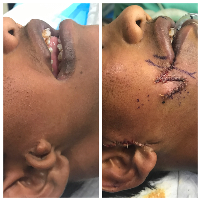 Plastic Surgery Mission Work Houston 