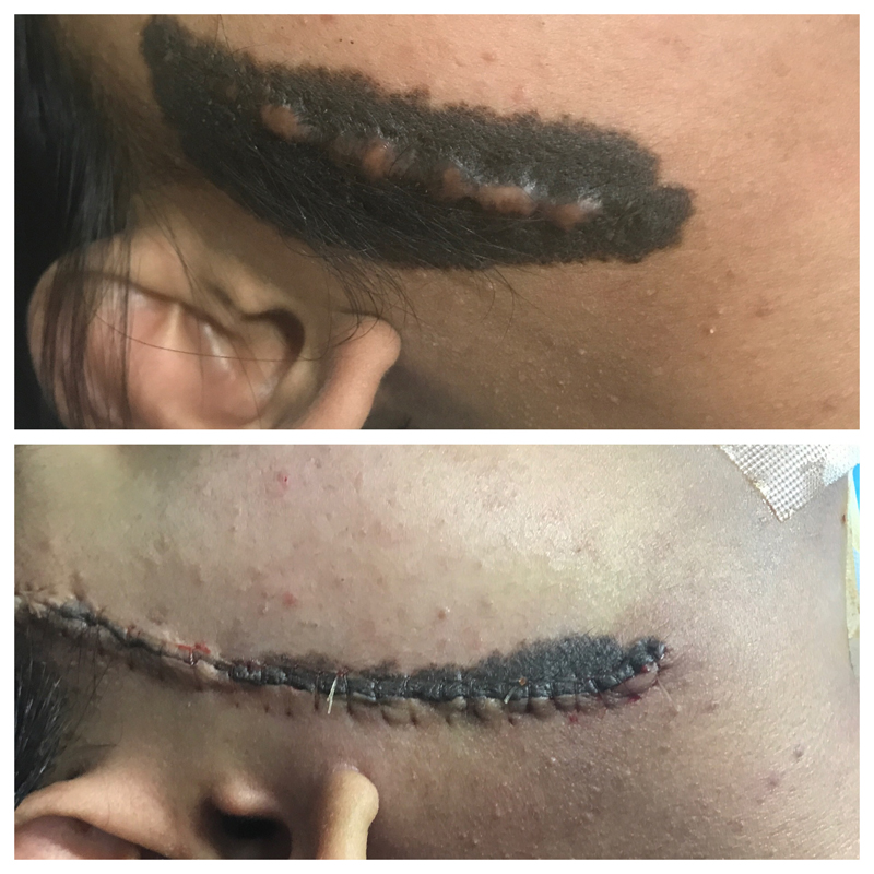 Plastic Surgery Mission Work Houston 