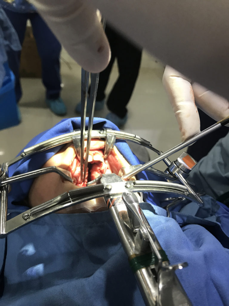 Plastic Surgery Mission Work Houston 