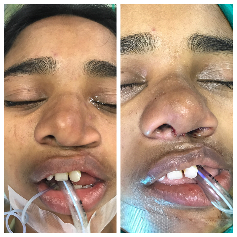 Plastic Surgery Mission Work Houston 