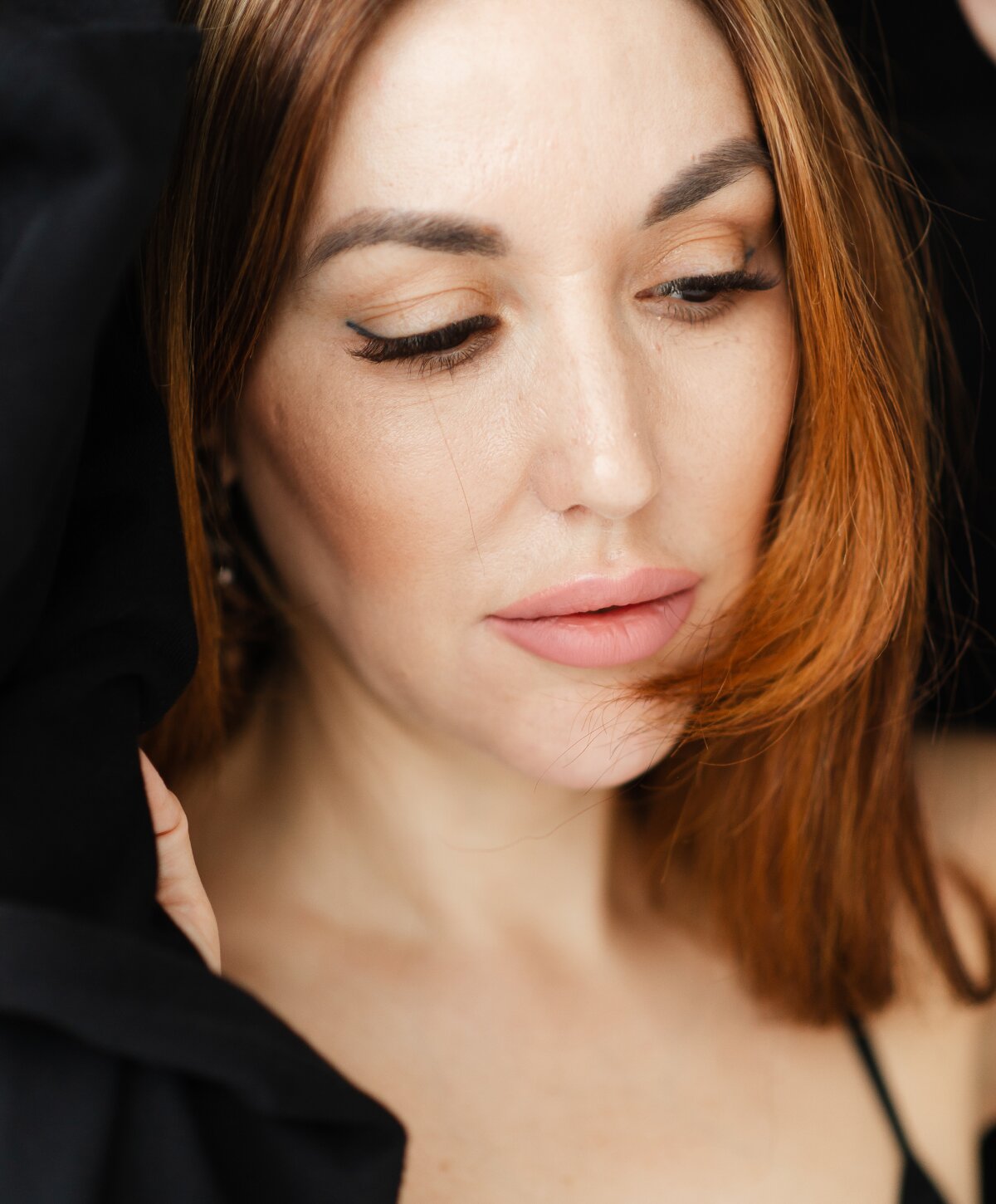 Botox for Migraines Houston 