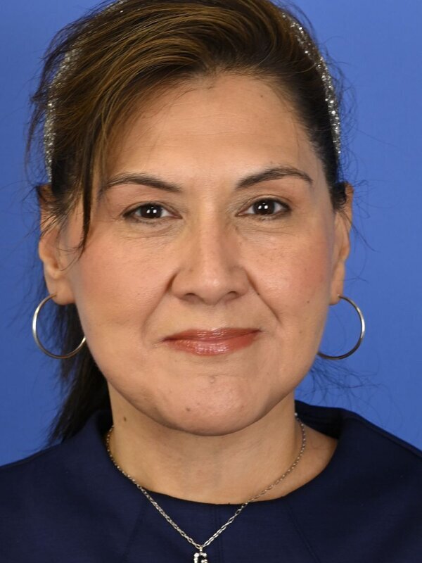 Face & Neck Lift Before & After Image