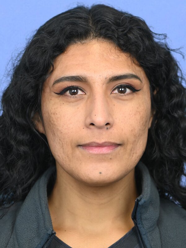 Facial Feminization Surgery Before & After Image