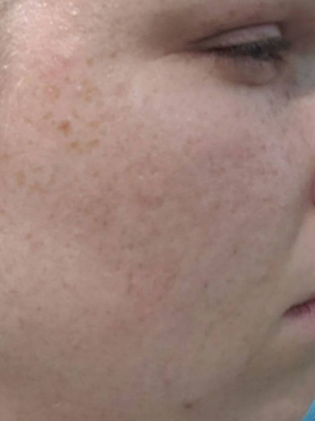 Skin Care Before & After Image